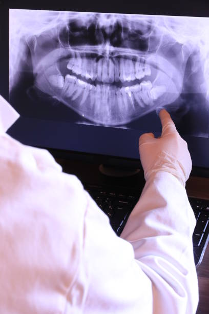 Best Emergency TMJ Treatment in Hightstown, NJ